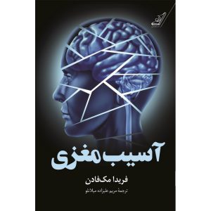 خرید آسیب مغزی فریدا مک فادن